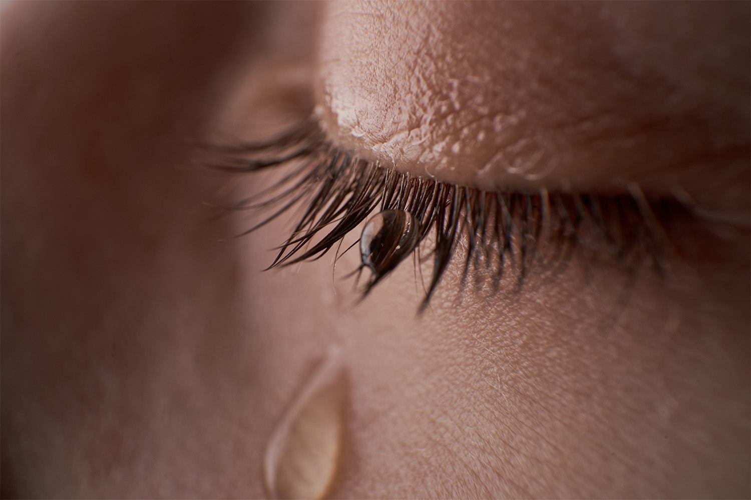 Why Do My Eyelashes Hurt After Eyelash Extensions? 7 Common Issues
